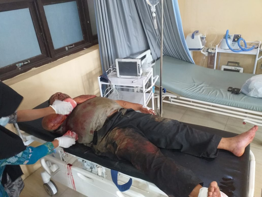 Kades Dibacok Warga, Polisi Amankan Tersangka